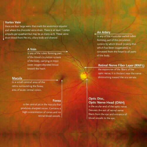 Qu es la OCT de retina?